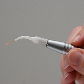 soft tissue laser in a dentist’s hands