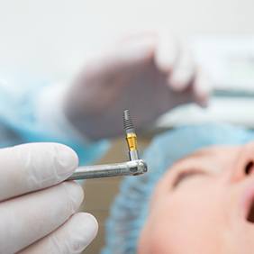 a dentist about to place a dental implant in a patient’s mouth