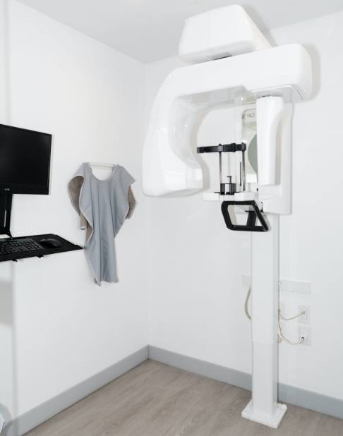 3 D C T cone beam digital x-ray scanner