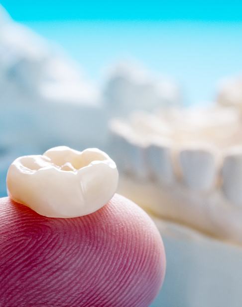 Closeup of dental crowns in New York