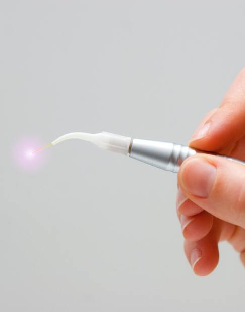 Soft tissue laser dentistry hand tool