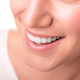 young woman smiling after getting veneers in New York